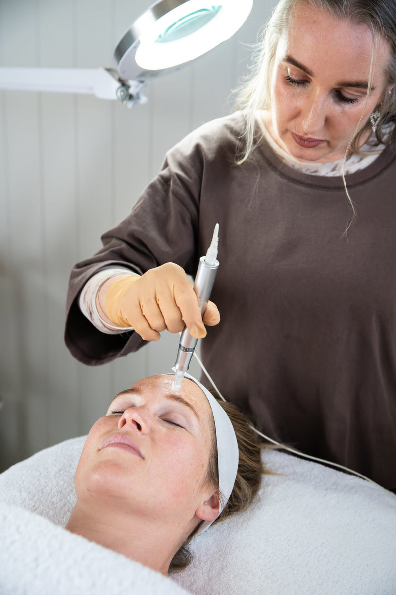 Your Best Summer Skin Starts in Winter: Why Winter Is the Best Time for Skin Needling